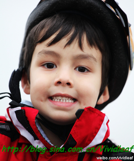 德国美白牙齿方法牙釉质再生,德国牙齿常规检查