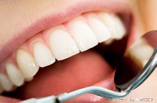 镶的烤瓷牙有什么不习惯的吗,为什么一定要镶烤瓷牙
