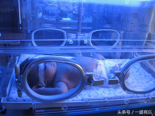 婴儿生理异常表现,新手妈妈需要知道哪些新生儿护理