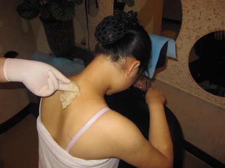 非遗药物竹罐的传承,非遗文化传承竹罐