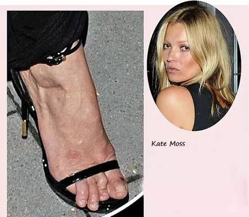 你的脚丫配得上新买的凉鞋吗?美足保养请戳这里