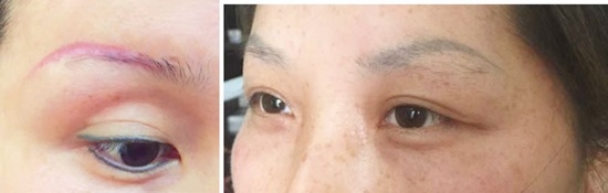 半永久纹绣哪种好用,韩式半永久是整容的意思吗