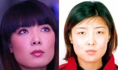 奥运冠军也爱美瘦脸箍牙后她们都美啦