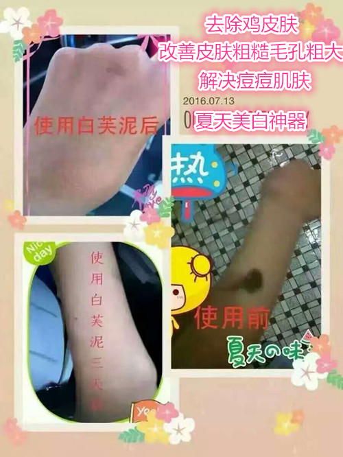 祛黑头3步轻松搞定顽固黑头,男士去黑头的最有效的方法