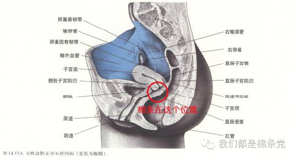 月经期用棉条下水安全么,用月经棉条就可以游泳么