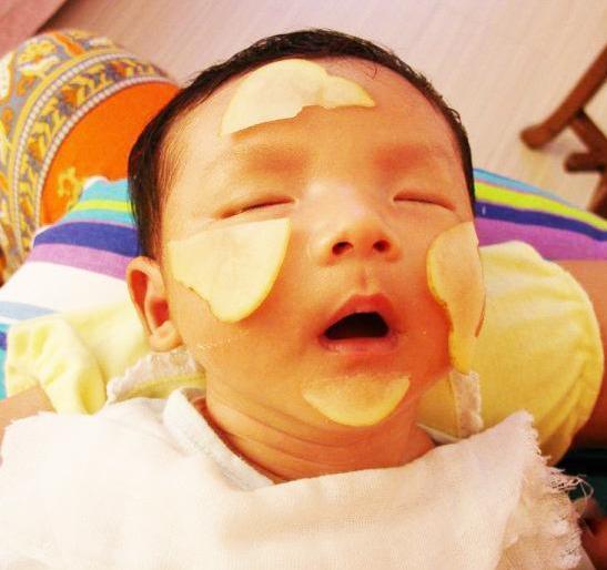 教你一招轻松祛痘,掌握祛痘四要素去除痘印很简单