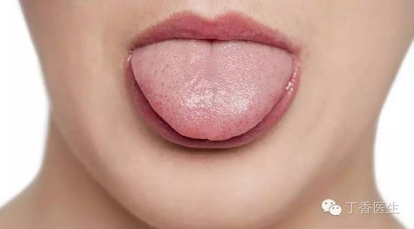 一张舌头看出几个健康问题,舌头上的健康状况图解