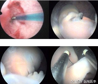 妇科门诊人流处理流程,妇科医生为什么总是建议流产