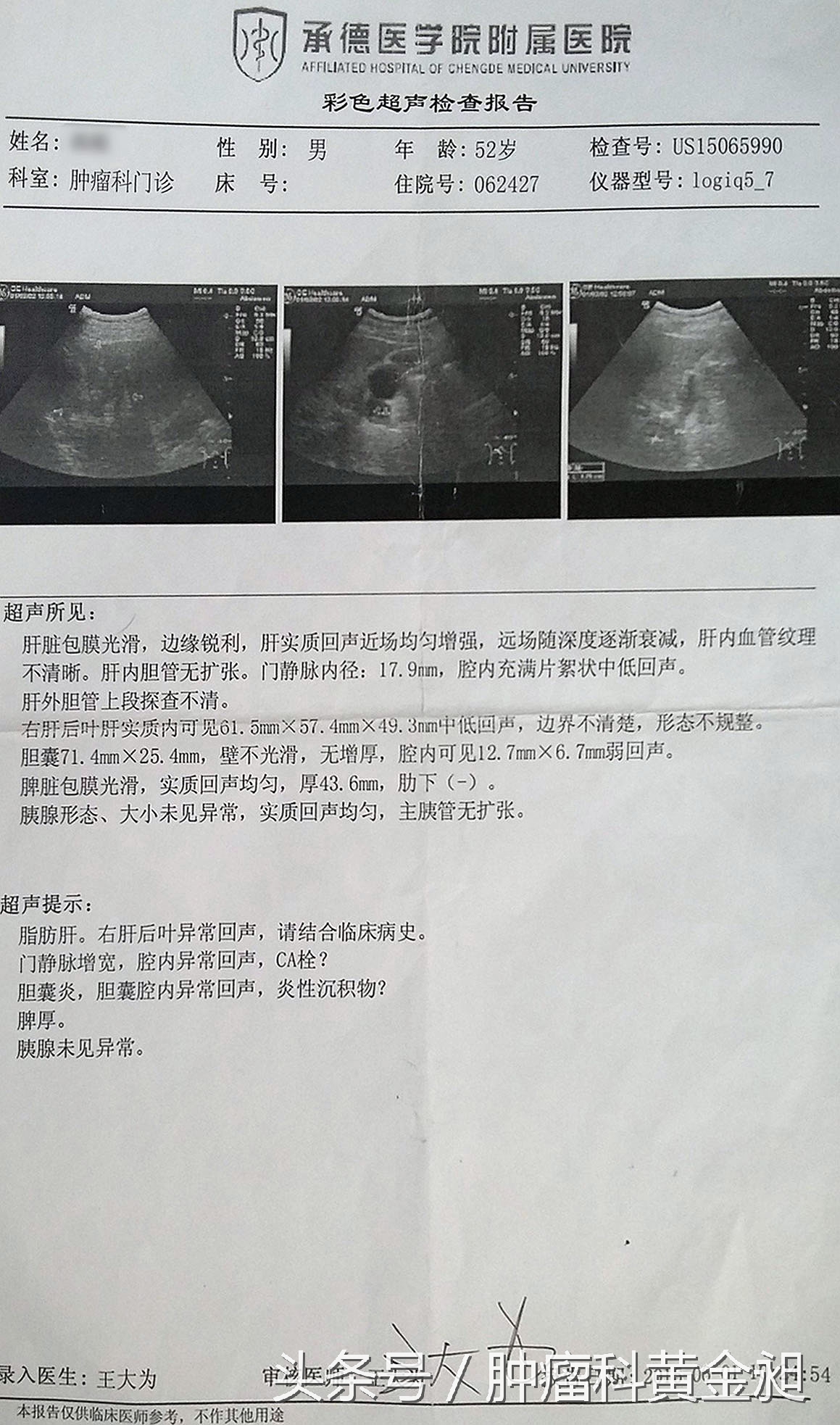 中药治疗肝癌晚期的成功案例,中药治肝癌肿瘤晚期的药方