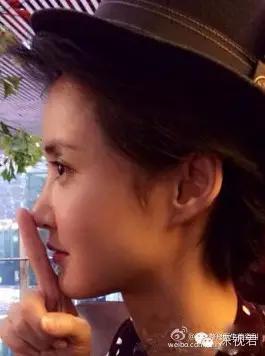 牙齿矫正舌侧牙套经历分享,牙齿矫正隐形牙套真人日记