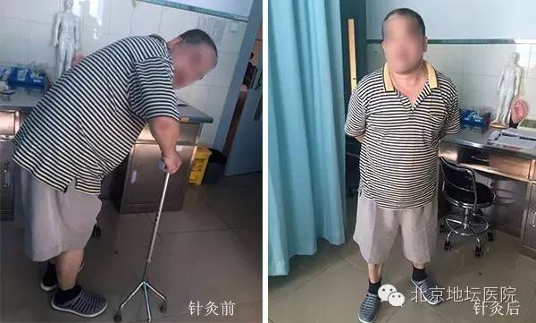 地坛中医医院,地坛医院针灸靠谱吗