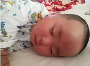 眼皮痒红肿脱皮起褶皱怎么修复,眼皮痒红肿脱皮起褶皱擦什么药膏