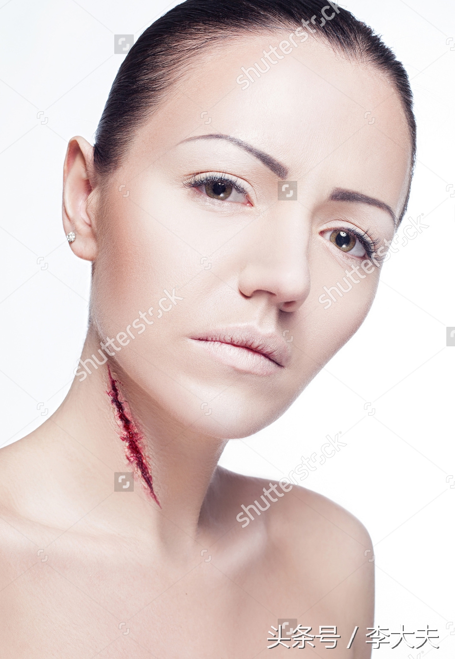 皮肤伤口增生,皮肤伤口愈合后反复长角质