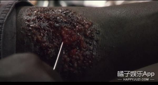 密集恐惧者请绕行,友情提示胆小的朋友请谨慎观看