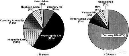 熬夜会导致自己猝死吗,熬夜能导致猝死吗