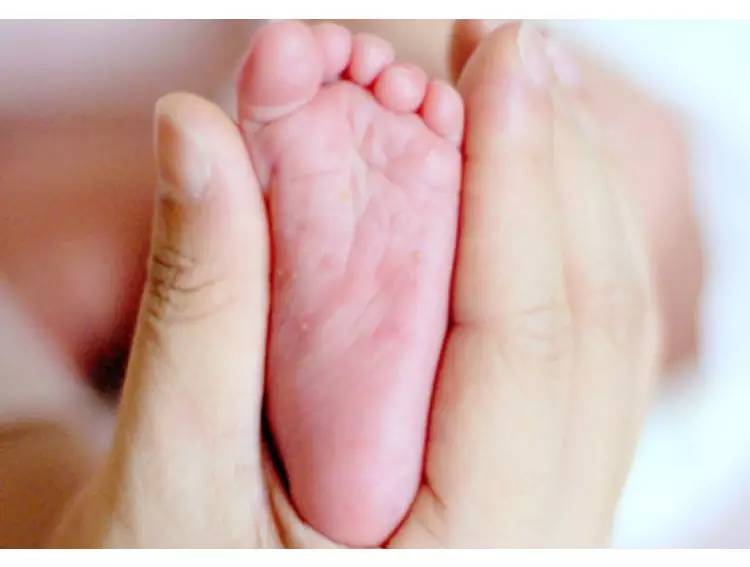 宝宝脚起像水泡一样的皮怎么回事,宝宝脚长满水泡