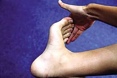 足底筋膜炎还可以跑步吗,跑步足底筋膜炎康复训练