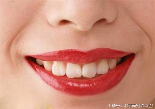 牙齿有小裂缝并且变黑,牙齿裂缝修复图片