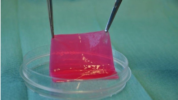 人造皮植皮手术后的效果,创伤人造皮肤修复过程