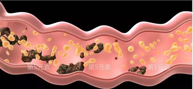 便秘口臭有色斑,便秘口干口臭长痘是啥子原因