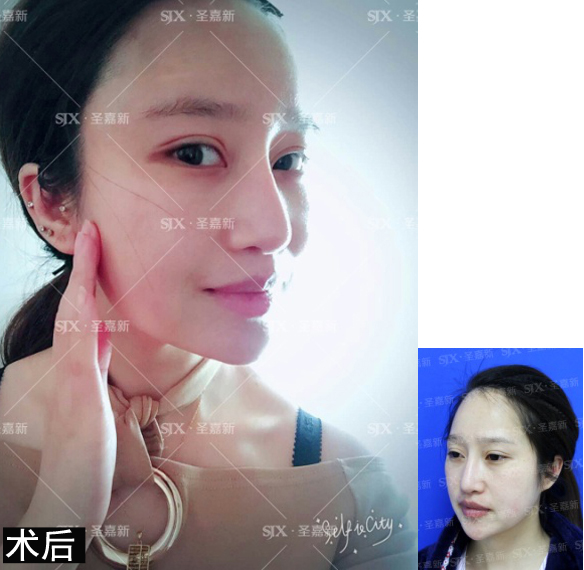 明明才20几岁看着显老,年纪不大看起来显老