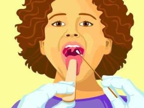 口咽癌居然是这种病毒导致的，想想就感觉恶心！