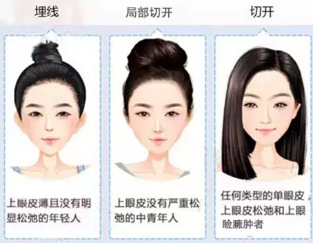 为什么大家都喜欢大眼睛双眼皮,为什么大家喜欢做双眼皮手术