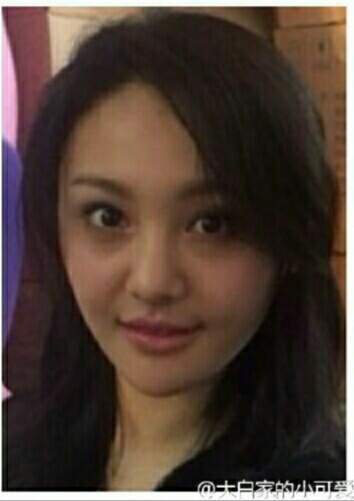 整容后遗症眼眨嘴歪,整容后遗症脸歪鼻子歪