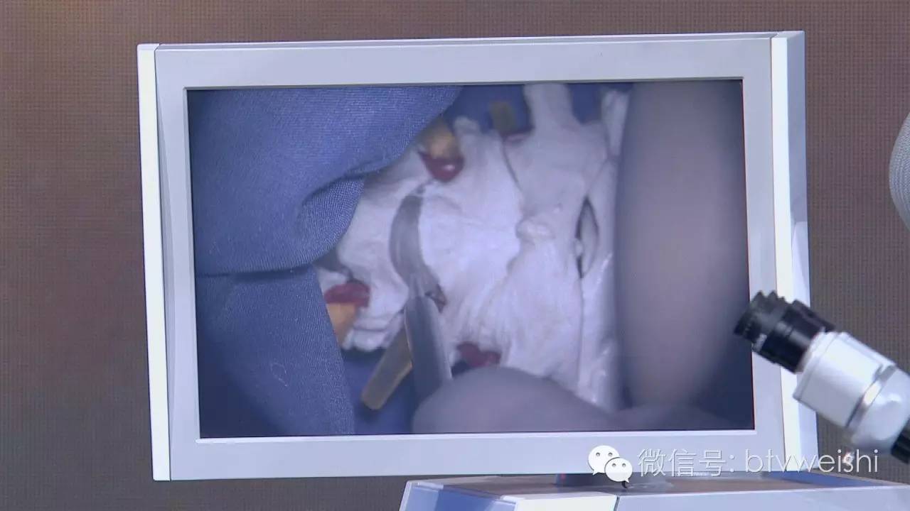 养生堂2020年5月19日养生节目,养生堂健康频道直播