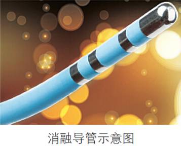 心源性猝死五大特征,心源性猝死的15个征兆