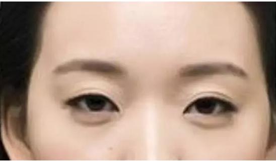 做美瞳线的技巧和方法,教你如何选择美瞳线