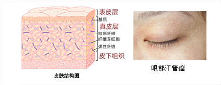 眼睛上有个小颗粒是什么,眼睛上的脂肪粒叫什么