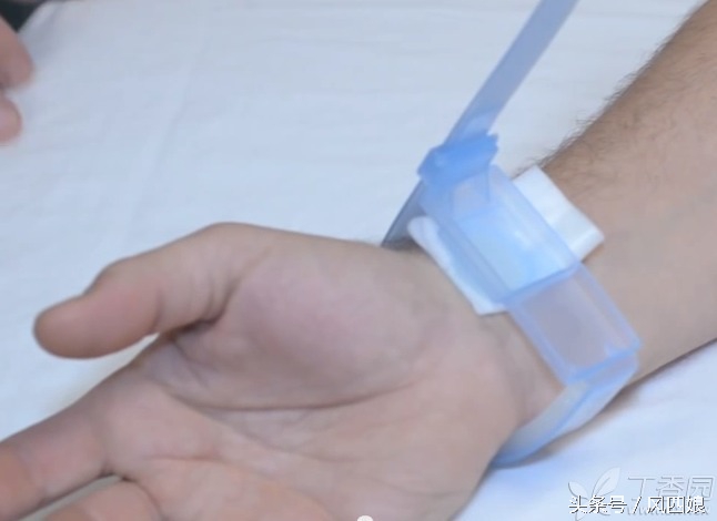 动脉采血后皮下出血怎么处理,动脉血管血肿如何消除