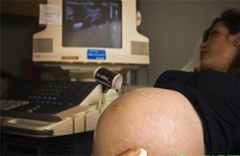 孕妇孕期症状注意事项,孕期常见的疾病有哪些