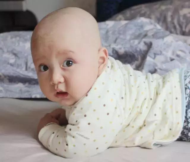 2岁孩子咳嗽有痰怎么处理,孩子过敏咳嗽的处理方法