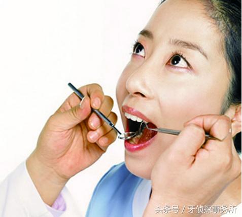 吃肉老是塞牙怎么彻底解决,吃肉塞牙时间长了会怎样