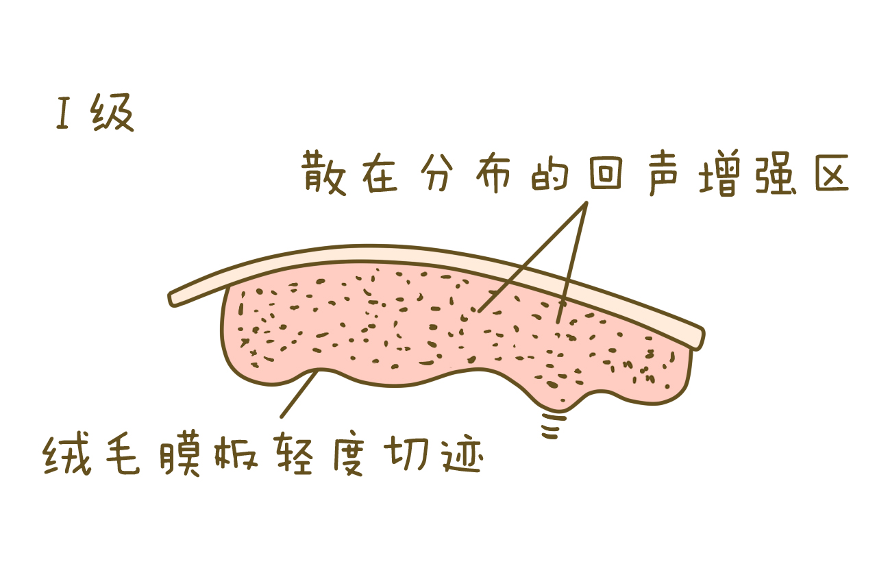 每一个孕妈都要经历的过程,每个孕妈必经生产过程