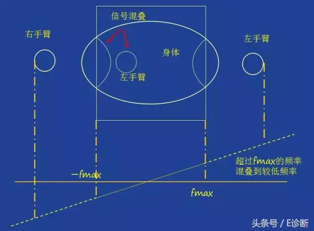 磁共振伪影及解决方案,e系列诊断
