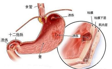 306医院做无痛胃肠镜多少钱,北京306医院胃肠镜预约