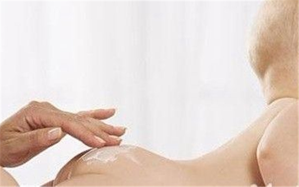 宝宝的尿布上有湿疹怎么办,宝宝得尿布疹怎么根治