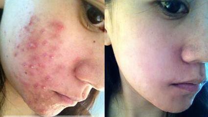 芦荟胶的妙用你知道吗,芦荟胶有什么用科普