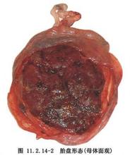 据说胎盘很好吃！妈妈们愿意尝尝吗？