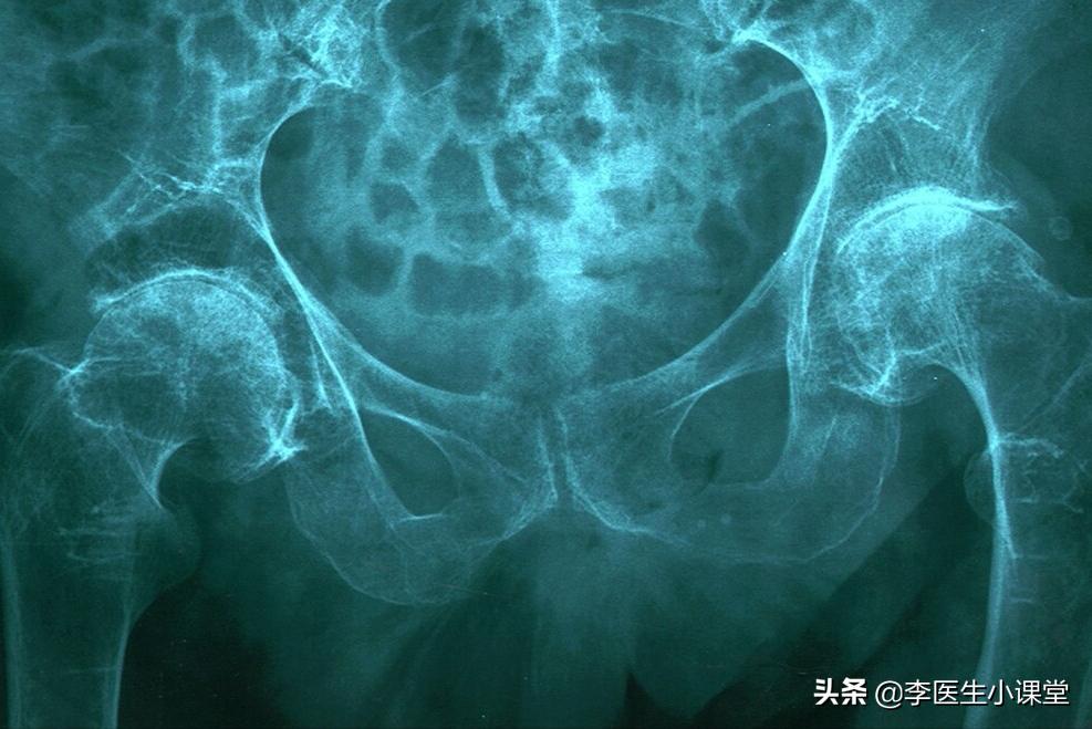 腿抽筋的原因是什么如何防治,腿抽筋是怎么回事怎么预防腿抽筋