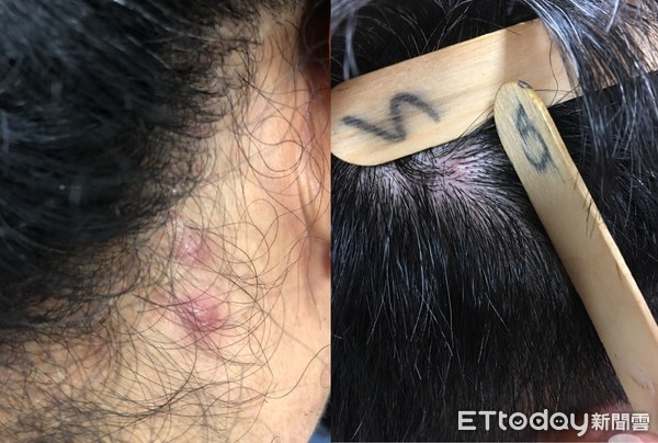 几天不洗头会出现大面积头皮,几天不洗头发的下场是什么