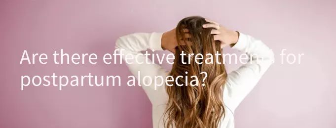 产后脱发怎么办最快最有效,产后脱发怎么办最有效的办法