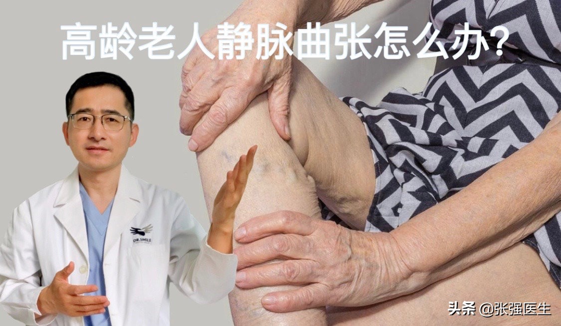 胃静脉曲张破裂前有什么征兆,老人静脉曲张严重怎么治疗最好