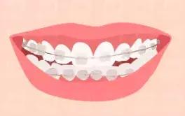 快看！这家店拯救了90%汕头人的牙齿烦恼