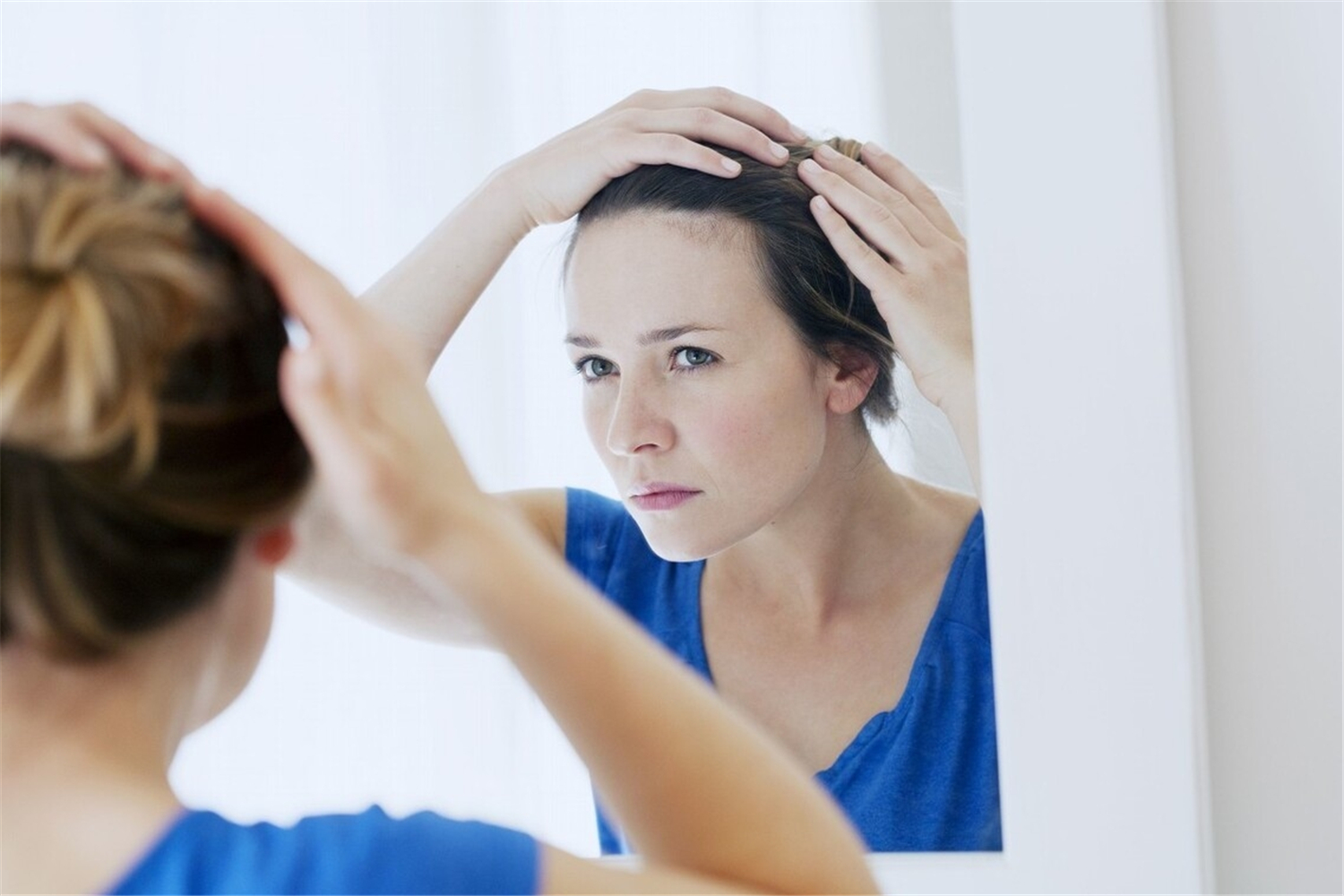 张歆艺产后掉发,张歆艺产后脱发