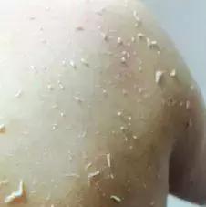 吸黑头神器去粉刺角质收缩毛孔,皮肤清洁收缩毛孔黑头角质