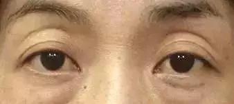 化妆真的能完全遮住瑕疵吗,化妆也掩盖不了岁月的痕迹